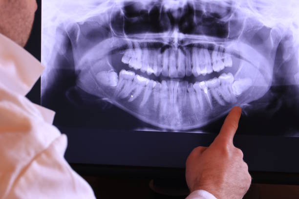 Best Tooth Infection Emergency Dentist  in Pennsboro, WV